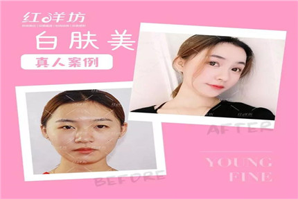 美丽·健康工程 | 《亲爱的，热爱的》火热开播，如何拥有“佟年”般无暇白皙的肌肤？